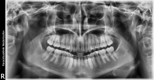 2015.01.05-OPT_FitzgeraldFrances